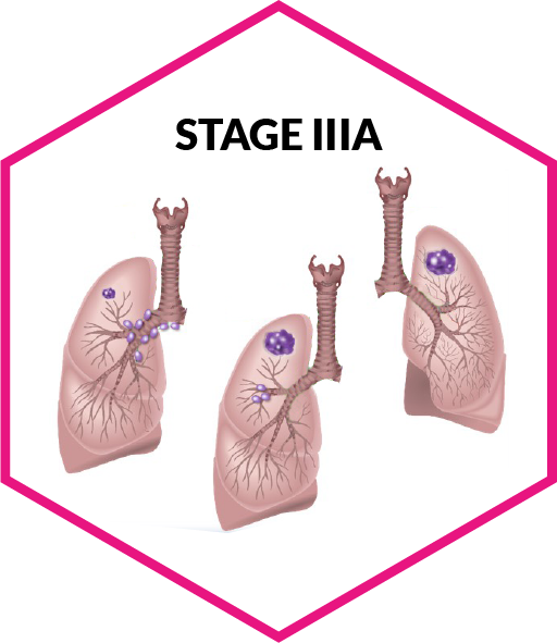 stage3a