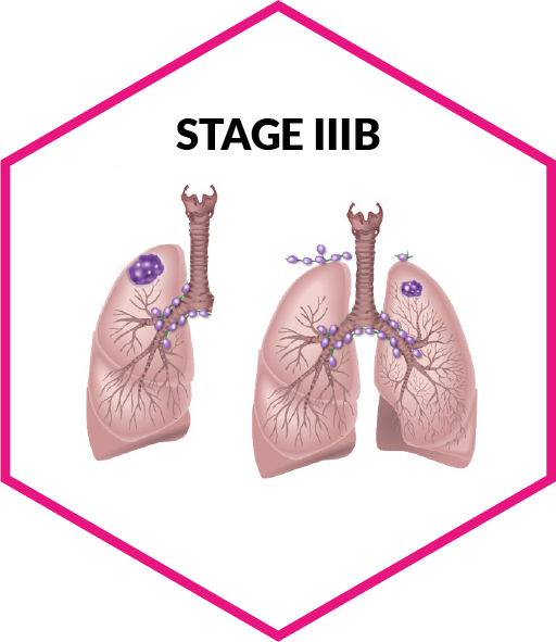 stage3a