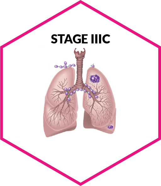 stage3a